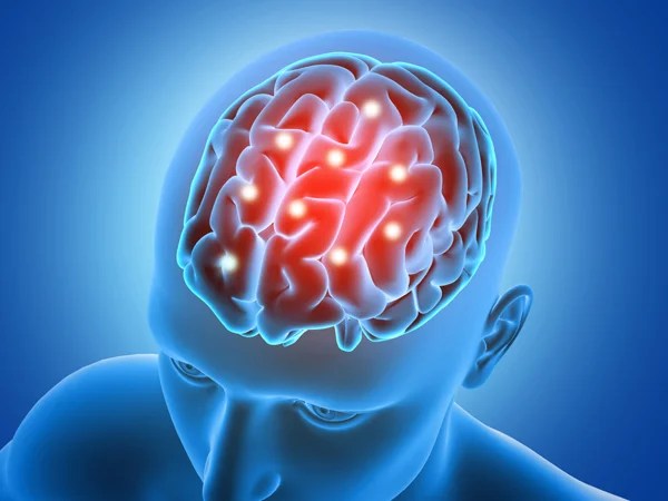 Brain Tumor