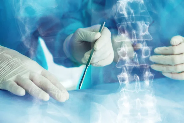 Minimally Invasive Spine Surgery